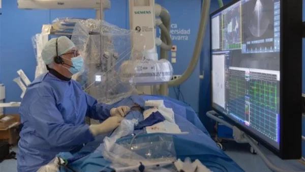 Fibrilación auricular.