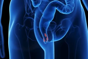 1800x1200_getty_rf_hemorrhoids_illustration_other