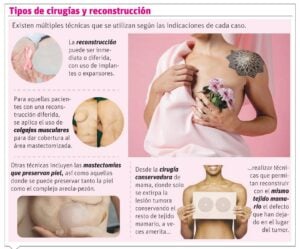info-TIPOS
