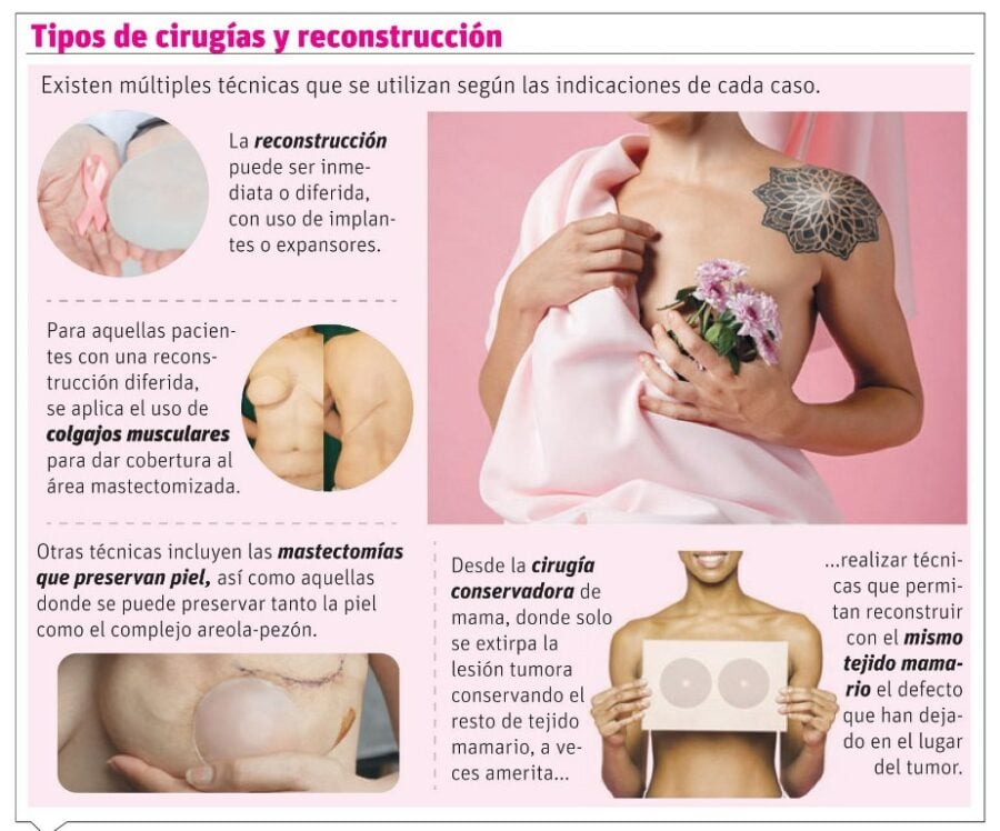 info-TIPOS
