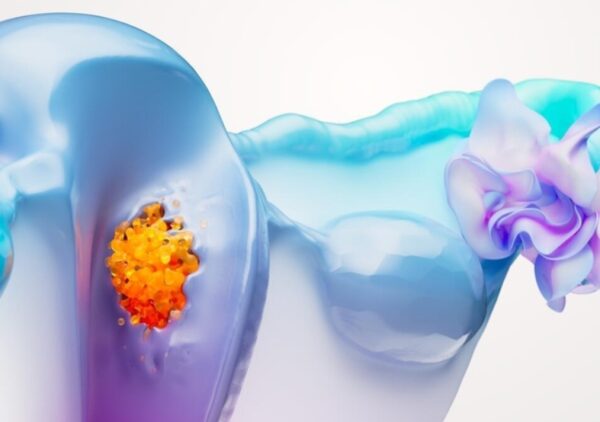 Las nuevas terapias están  transformando el panorama.