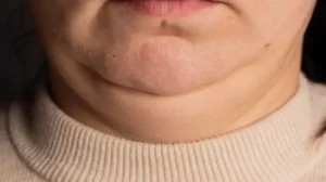 Si tu cuello se ve más grueso o más delgado de lo habitual, puede indicar algunos problemas de salud.