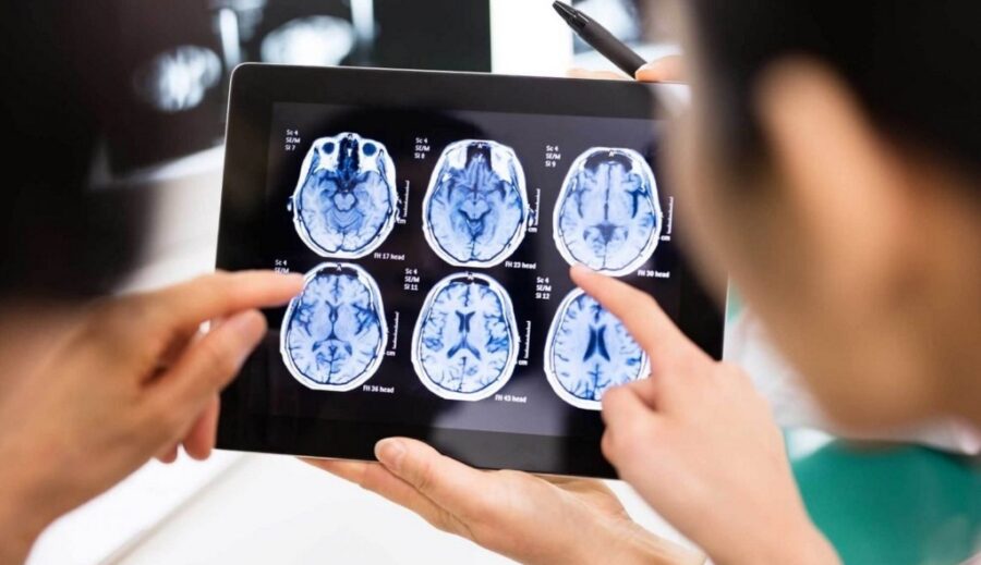 Los tumores cerebrales son genéticamente diversos y heterogéneos. fuente externa