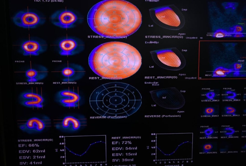 Es  para la detección temprana de enfermedad coronaria.