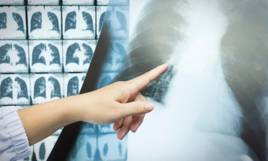 A pesar de la evidencia científica, muchos pacientes aún sienten temor o desconfianza frente a la tomografía.