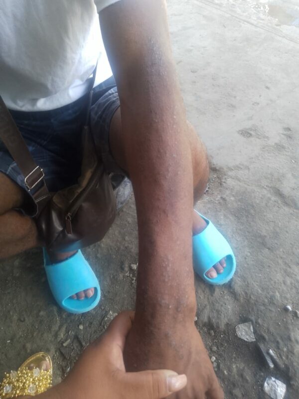 Vecinos de Manoguayabo