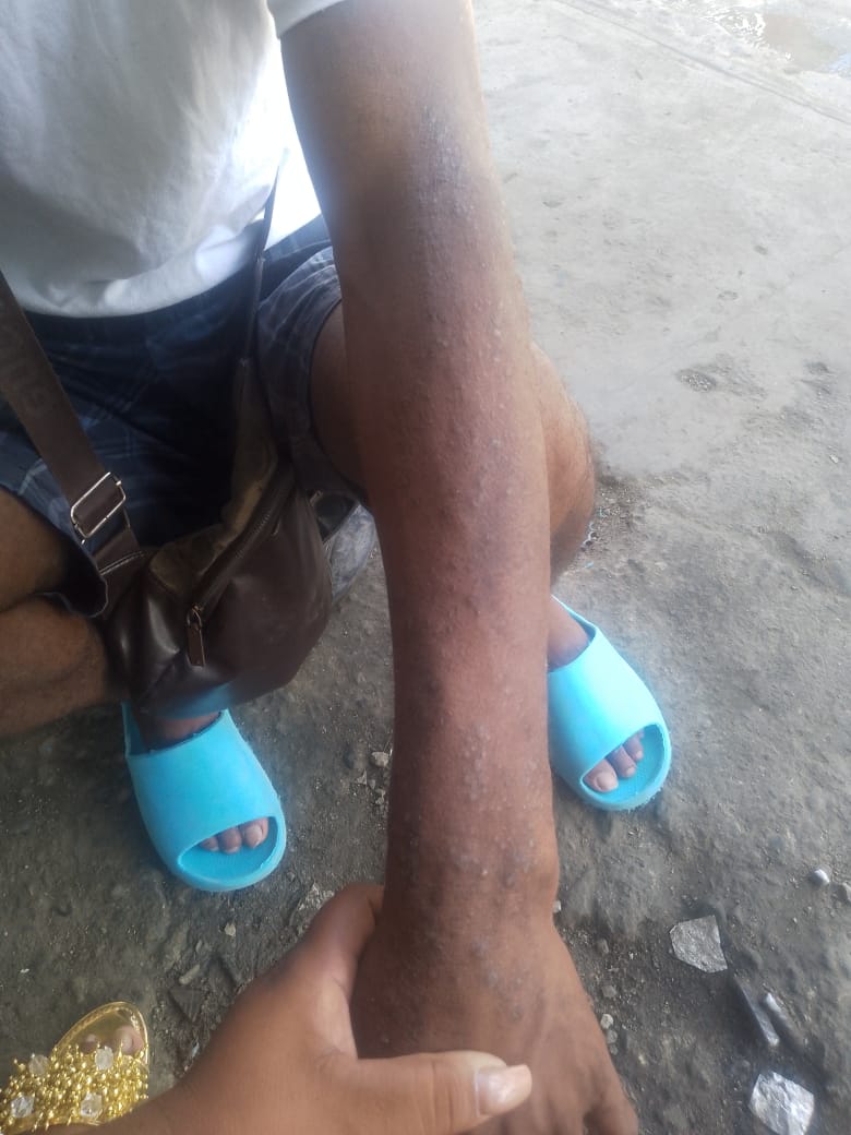 Vecinos de Manoguayabo