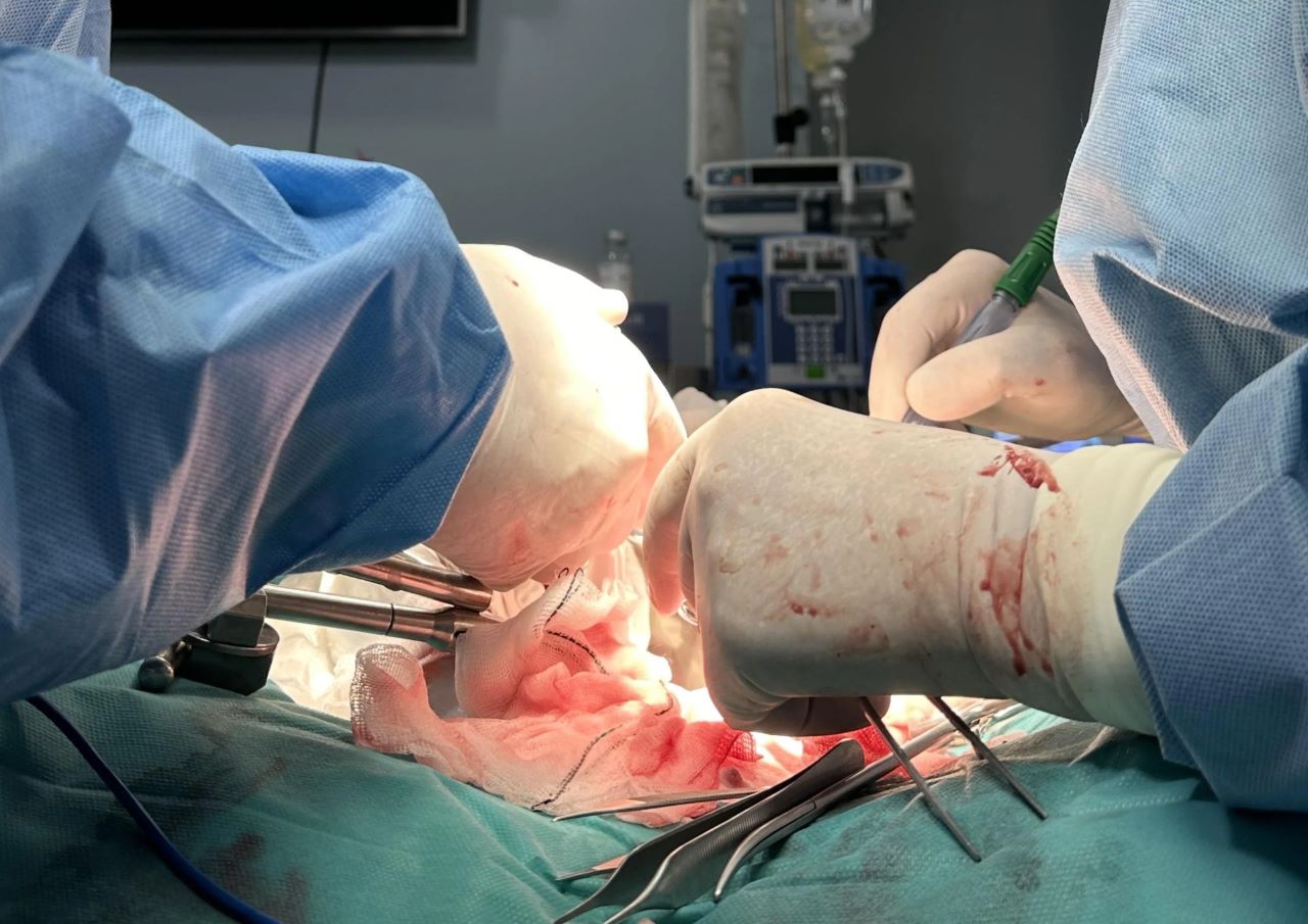 Científicos españoles logran trasplantar riñones de cerdo modificados con organoides humanos