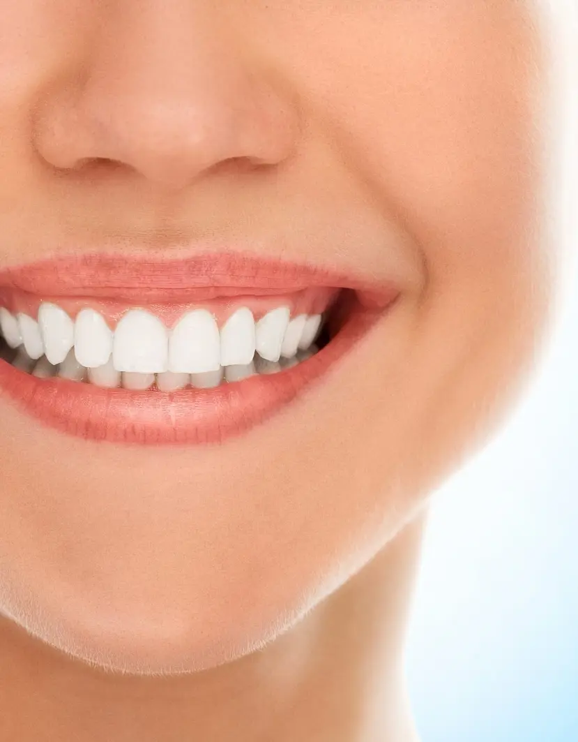 Cómo proteger los implantes dentales de los excesos de Navidad