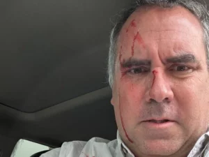 Fotografía tomada de la cuenta oficial @CostaGino de la red social X del excongresista de Perú, Gino Costa, donde se observa al candidato presidencial Rafael Belaúnde Llosa herido tras sufrir un atentado, en Lima (Perú).