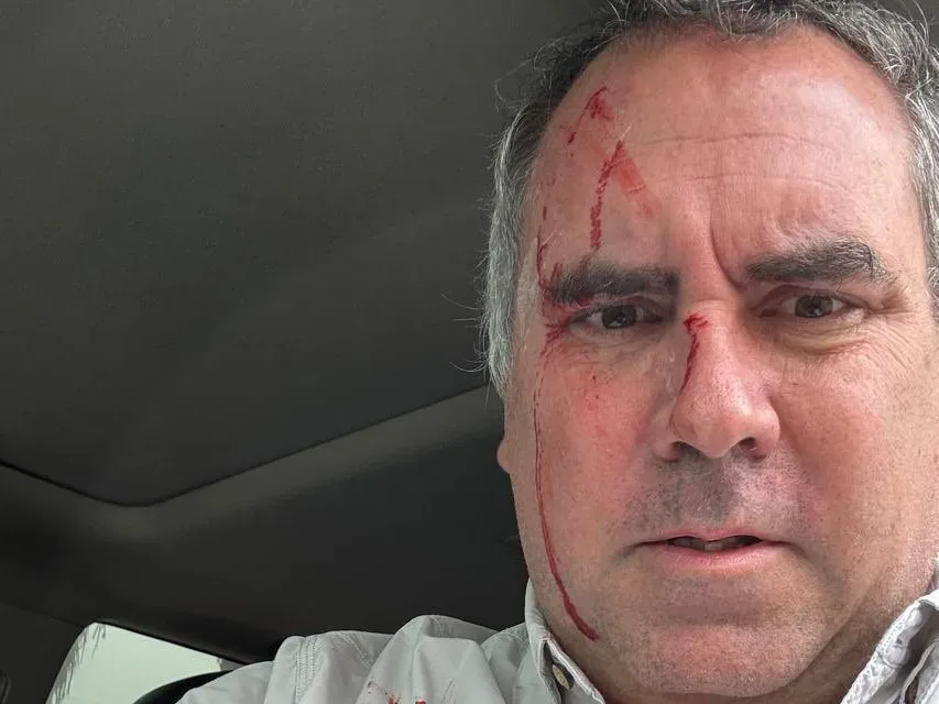 Fotografía tomada de la cuenta oficial @CostaGino de la red social X del excongresista de Perú, Gino Costa, donde se observa al candidato presidencial Rafael Belaúnde Llosa herido tras sufrir un atentado, en Lima (Perú).