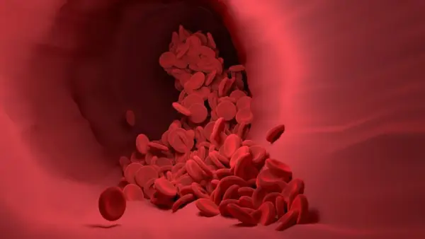 El protocolo BrECADD combina quimioterapia avanzada y terapia biológica dirigida, reduciendo la necesidad de radioterapia en el linfoma de Hodgkin