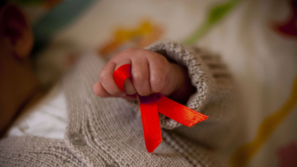 VIH-niños con vih-sida