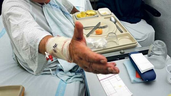 desnutricion-pacientes-cronicos