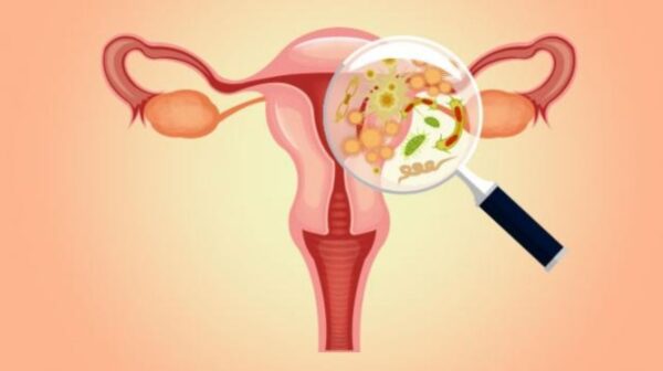 No todas las secreciones son patológicas ni todas corresponden a un cuadro de vaginitis.