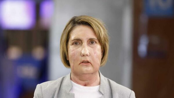 Carmen, la paciente que recibió el trasplante facial