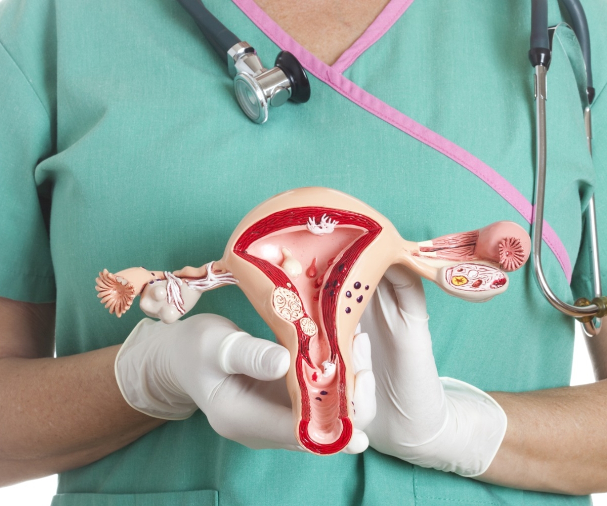 El papiloma humano y cáncer cuello uterino se puede prevenir