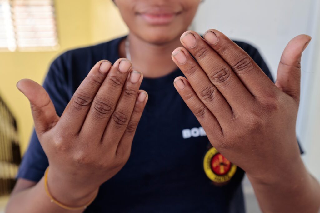 Con orgullo, Celia muestra al equipo de prensa sus manos teñidas por el humo, testigos silenciosos de su oficio.