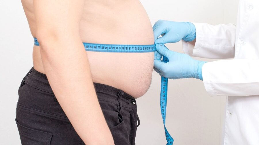 Obesidad en el país afecta al 70% de los adultos, según indica el ministro de Salud.