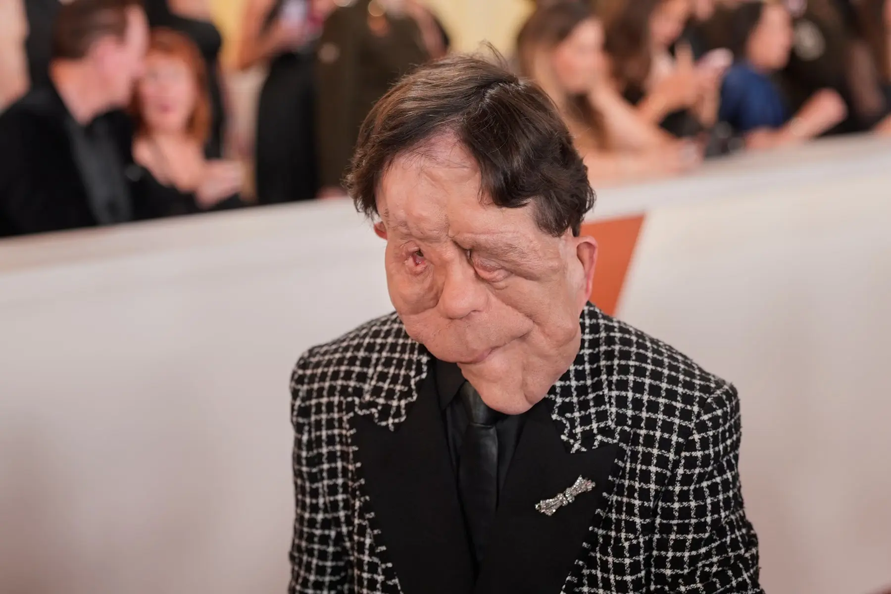Adam Pearson: La enfermedad genética que padece y que despertó preguntas en los Óscar