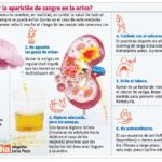 “La sangre en la orina es una señal de alerta”