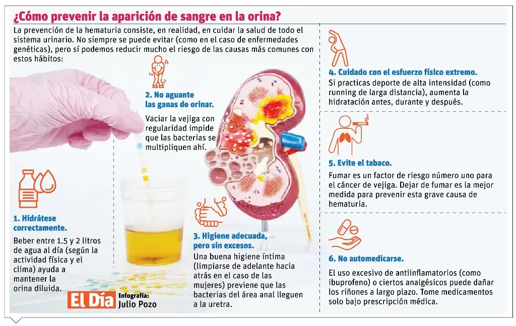 “La sangre en la orina es una señal de alerta”
