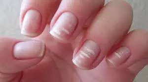 iuñas