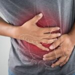 Aumentan los casos de cáncer de colon en menores de 50 en NYC