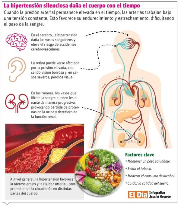 info-HIPERTENCION SILENCIOSA