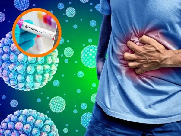 Norovirus1