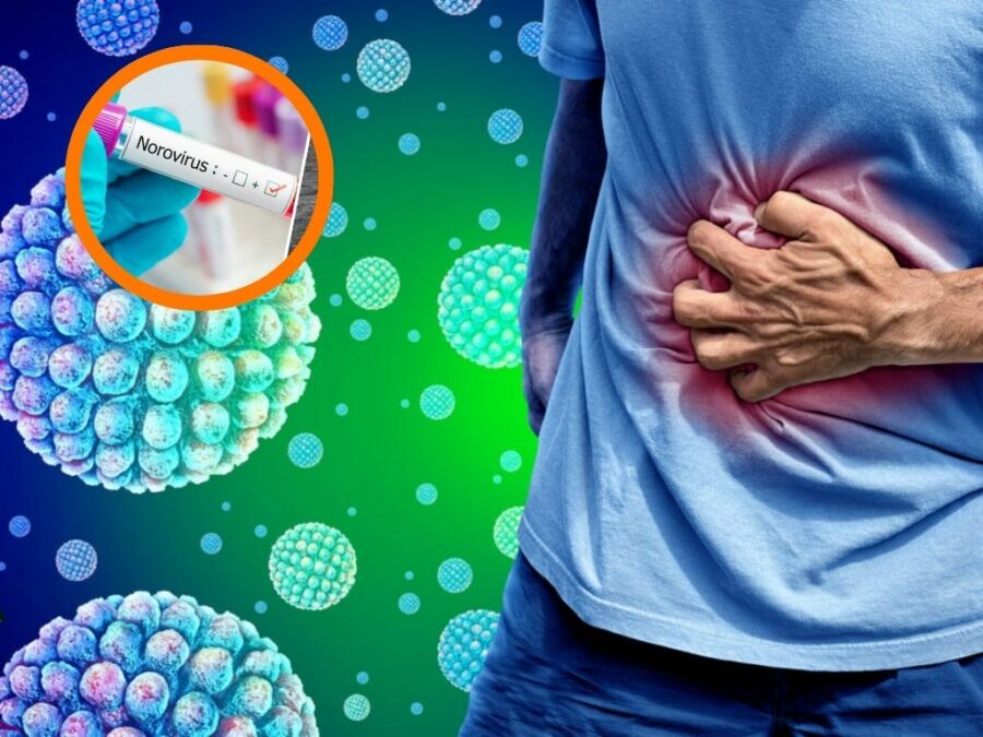 Norovirus1