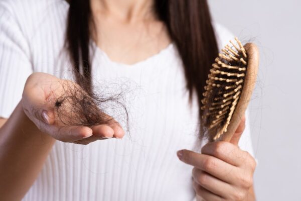 caida-del-pelo