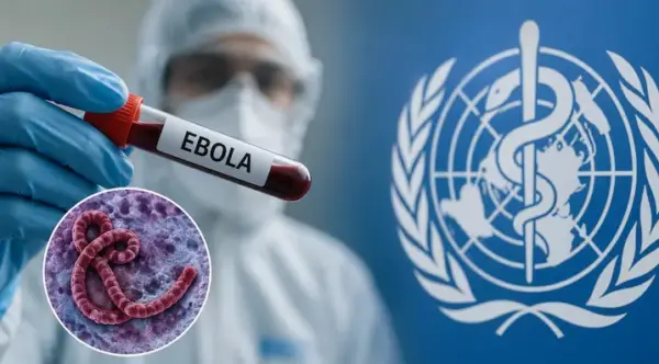 ébola