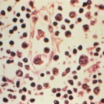 Hantavirus: la diferencia clave con el covid que tranquiliza a los científicos