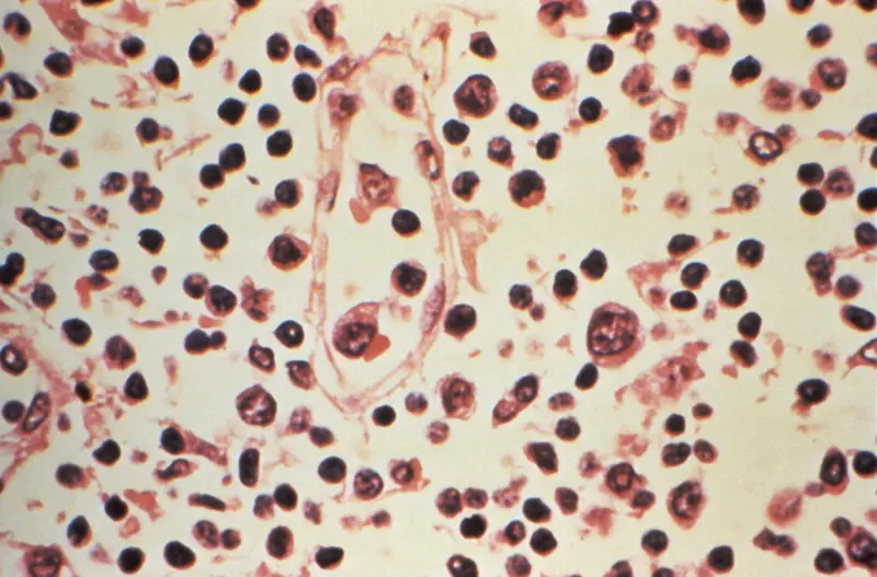 Brote de hantavirus: por qué los cruceros son lugares propicios para la propagación de enfermedades infecciosas