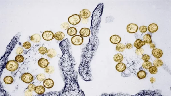 virus