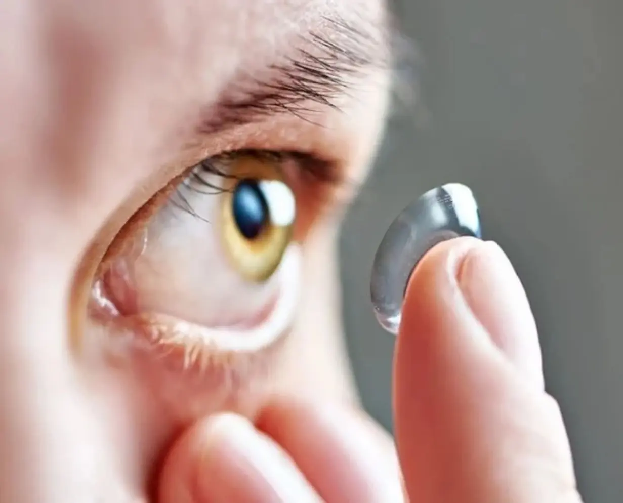 Los lentes de contacto ayudan a tratar algunas condiciones oculares