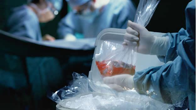 ¿Qué órganos y tejidos se pueden donar en vida y cuáles después de fallecer?