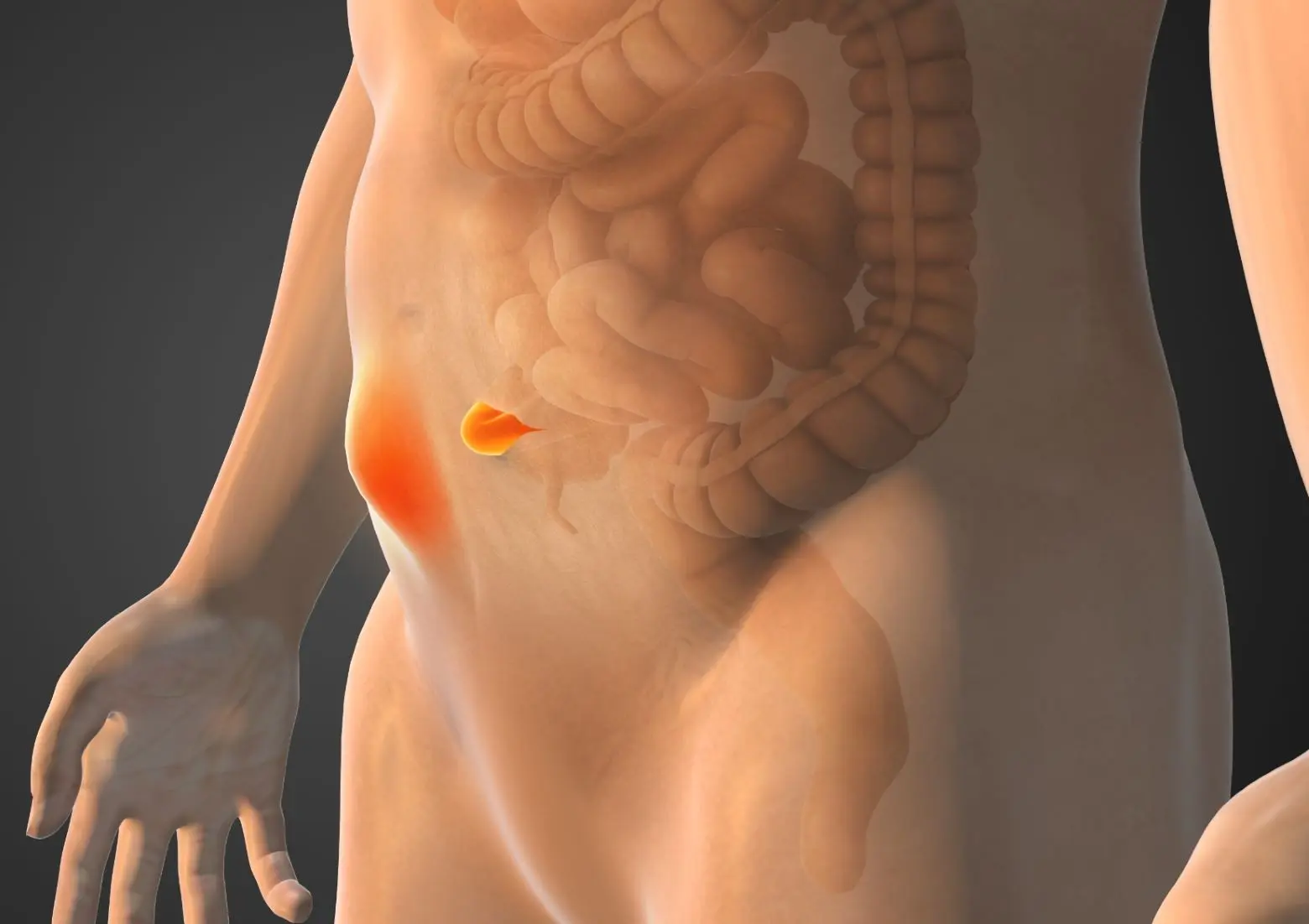 Tratamientos para tratar las hernias de la pared abdominal