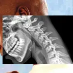 "Cuerpo de teléfono": cómo la tecnología nos arruga el cuello y debilita las manos