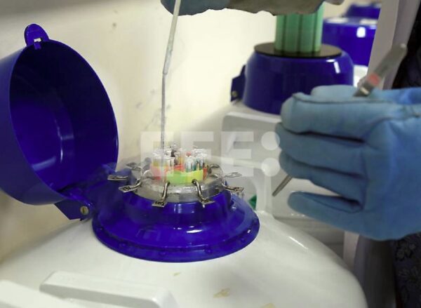prueba de semen