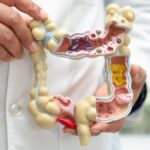Crohn y colitis ulcerosa son enfermedades crónicas que inflaman el intestino