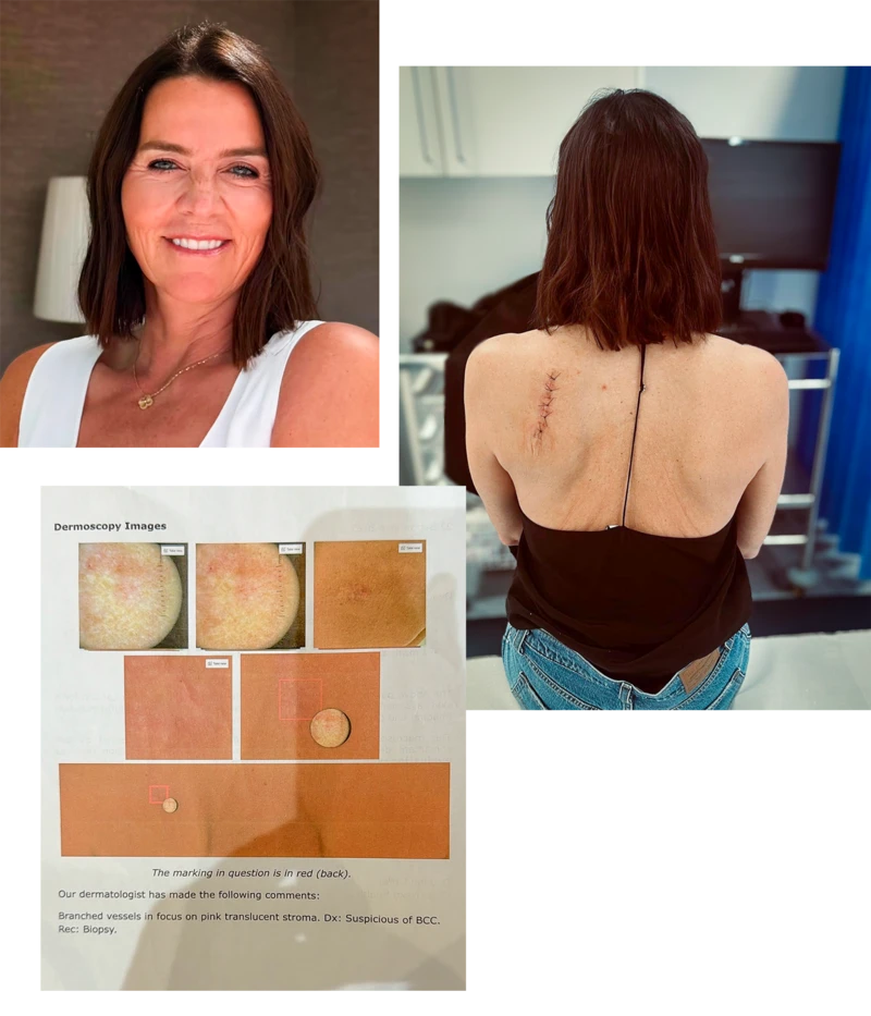 "Me hice un escáner que tomó 2.000 fotos de mi cuerpo y aprendí una inesperada lección sobre mi piel"