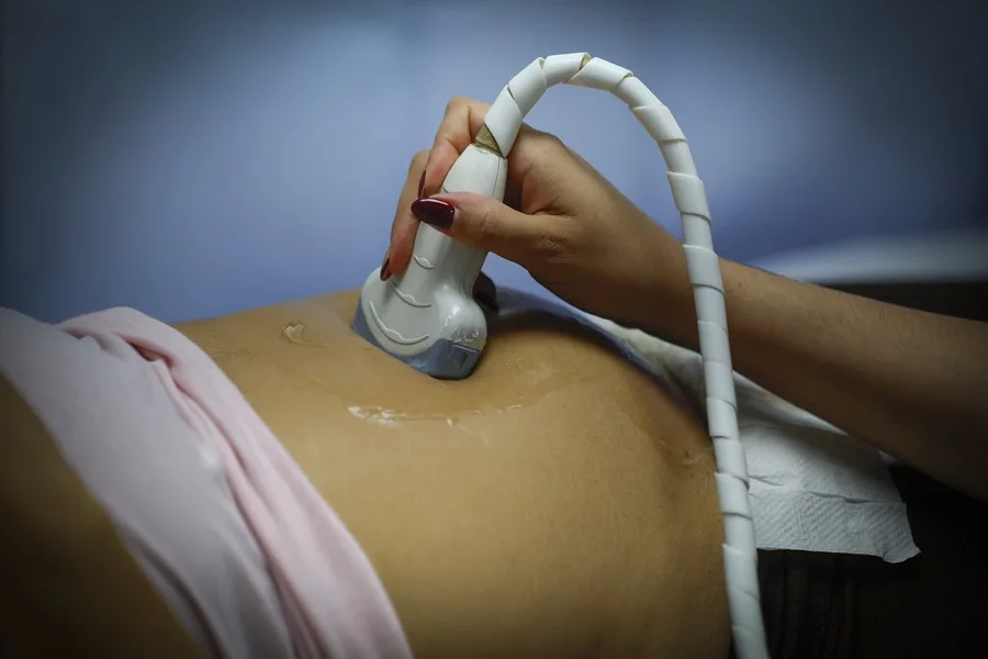 Fotografía de archivo de una mujer embarazada se realiza un ultrasonido.