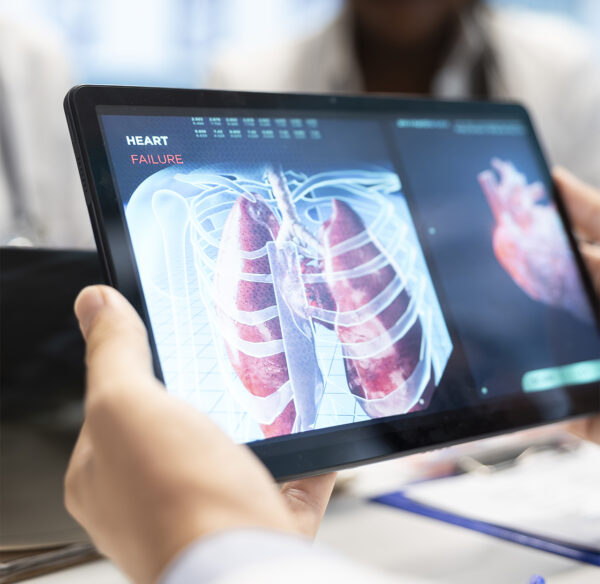 Pruebas genéticas modifican el tratamiento de pacientes con fibrosis pulmonar