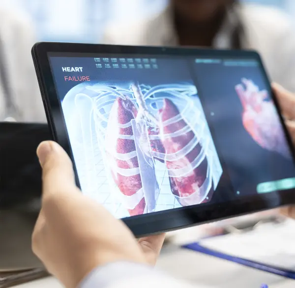 Pruebas genéticas modifican el tratamiento de pacientes con fibrosis pulmonar