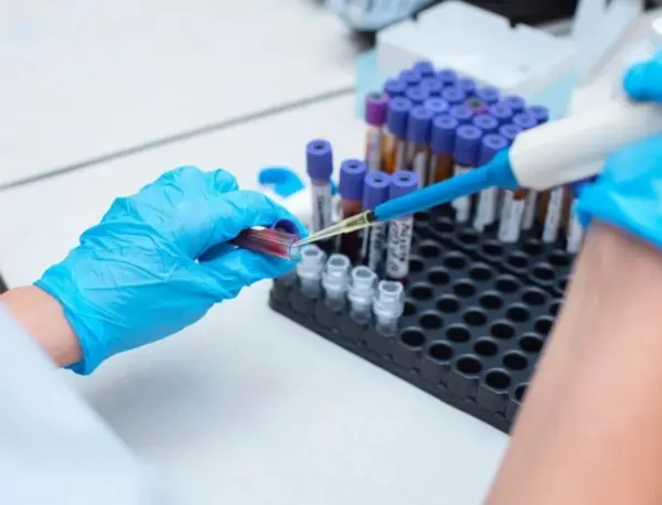 Más allá de las implicaciones médicas, recibir un diagnóstico de VIH puede desencadenar un proceso emocional complejo.