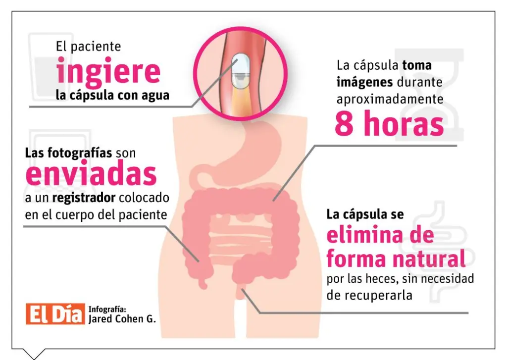 Cápsula endoscópica: una pequeña cámara capaz de recorrer el intestino