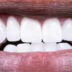 Esto es lo que tienes que comer para proteger las bacterias beneficiosas de tu boca