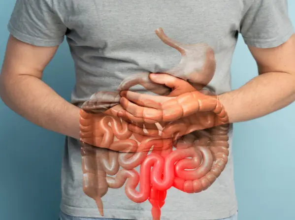 Especialista advierte sobre enfermedades inflamatorias intestinales y llama a detectar síntomas a tiempo